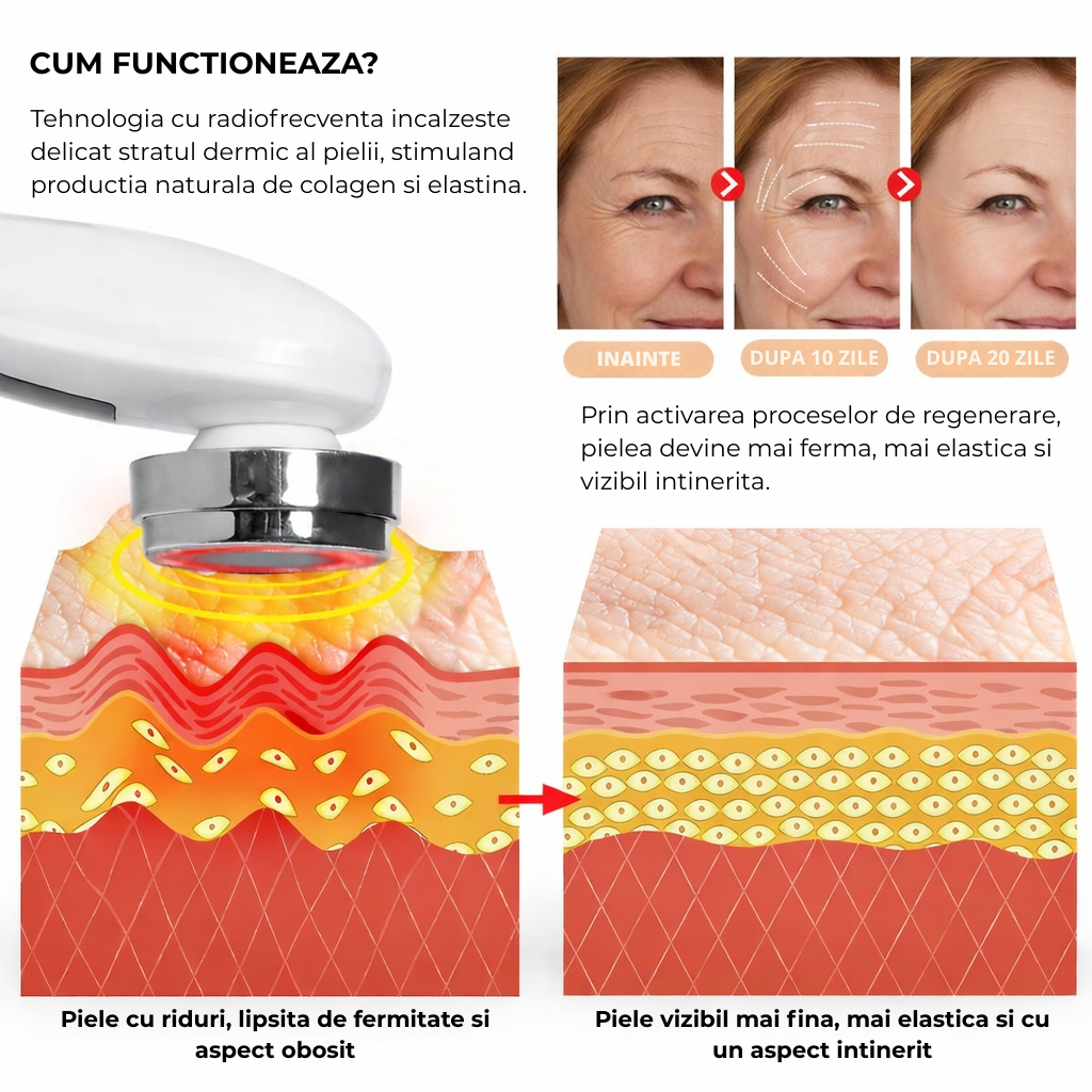 Aparat Lifting Facial 7 Moduri – EMS, RF si LED Anti-Rid si Reintinerirea Tenului