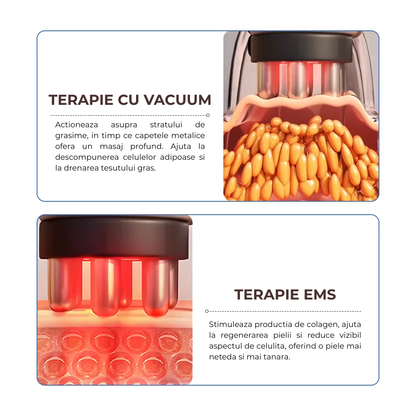 Dispozitiv 4 in 1 pentru Modelare Corporala si Lifting Facial – EMS, LED si Masaj Anticelulitic