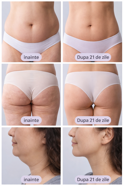 Dispozitiv 4 in 1 pentru Modelare Corporala si Lifting Facial – EMS, LED si Masaj Anticelulitic