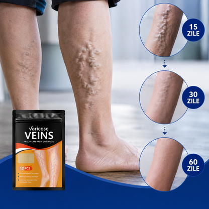 Set 12 Plasturi VenoConfort™ pentru Varice și Îngrijirea Picioarelor Inflamate
